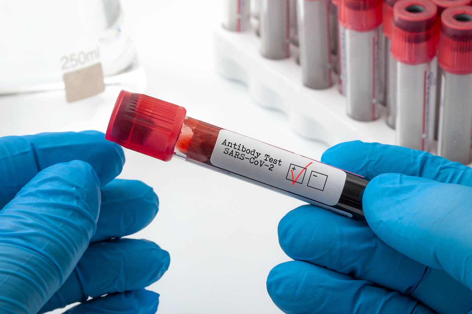 COVID-19 Antibody Testing